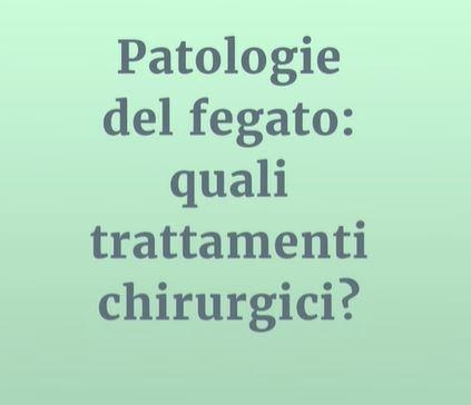 notizia