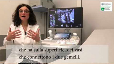 tutti i tutorial